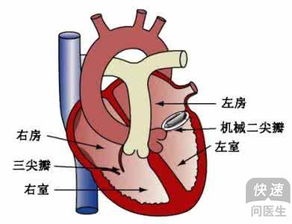 心脏瓣膜病的日常注意