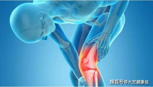 膝关节退行性变的护理措施