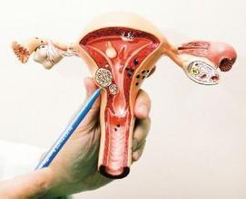 雌激素对子宫肌瘤的影响