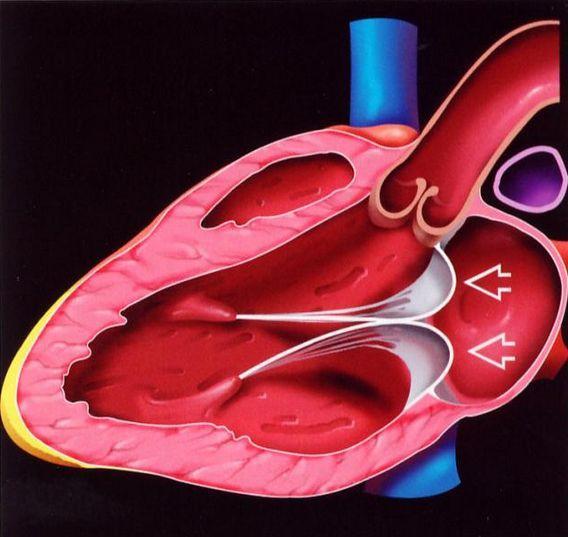 心脏瓣膜病平常的保养