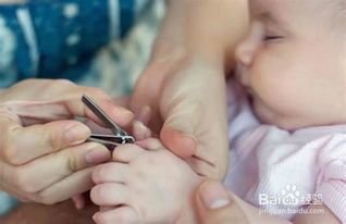 婴幼儿湿疹护理与日常注意事项