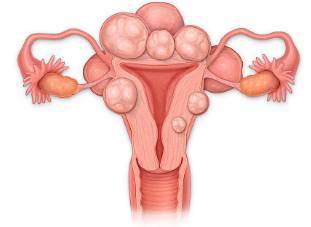 总黄酮对子宫肌瘤有影响吗女性