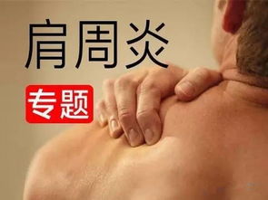 肩周炎患者康复训练旋前固定位置