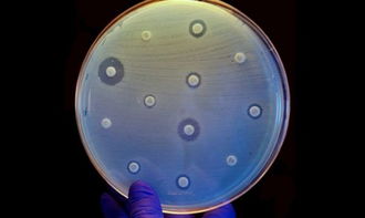 耐药性细菌感染怎么治疗好得快