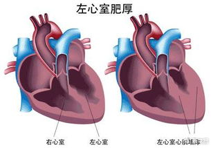 心血管药物的三种临床用途