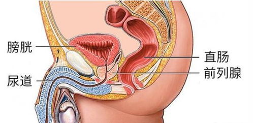 前列腺初期如何治疗