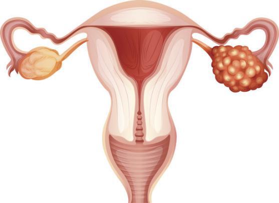 雄激素过多会影响月经吗